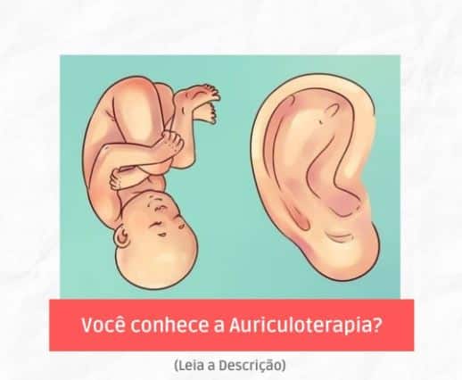 auriculoterapia